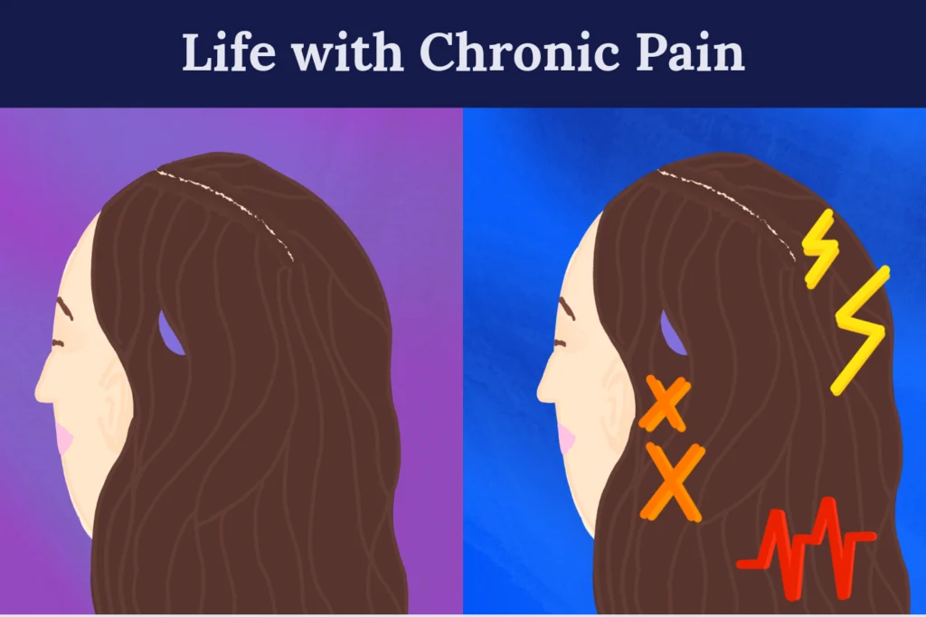 Life with Chronic Pain | Art Piece of two drawings.